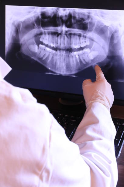 Best Knocked-Out Tooth Emergency  in Quartz Hill, CA